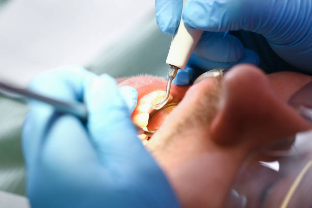 Best Emergency Dentist for Lost Fillings or Crowns in Comanche, TX