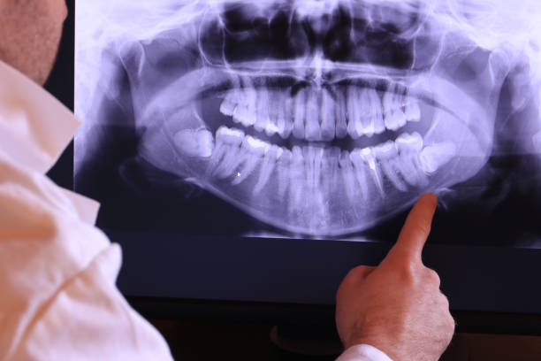 Best Broken or Cracked Tooth Emergency Dentist in Comanche, TX